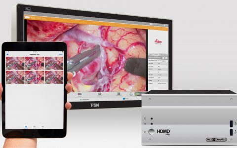 HDMD™ All-in-One